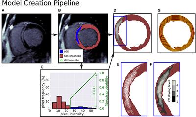 Fibrosis Microstructure Modulates Reentry in Non-ischemic Dilated Cardiomyopathy: Insights From Imaged Guided 2D Computational Modeling